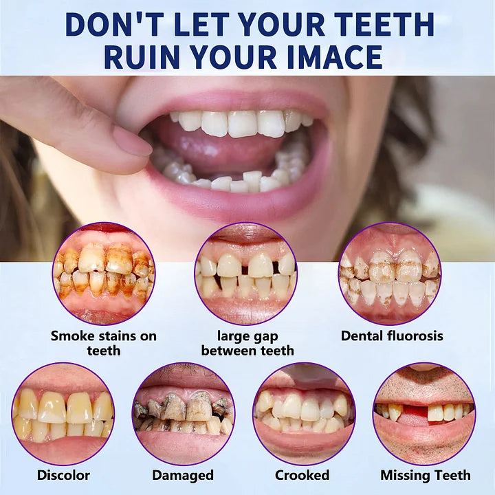 HermsaĀ®-š¦·Advanced Customized Full Denture Set𦷠(ā°Limited time discount last 30 minutesā°)